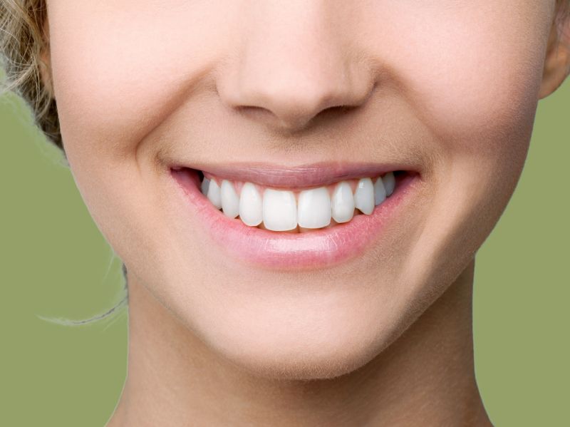 Teeth Whitening